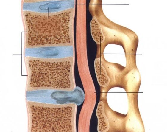 Die Hernien werden ausgesprochen