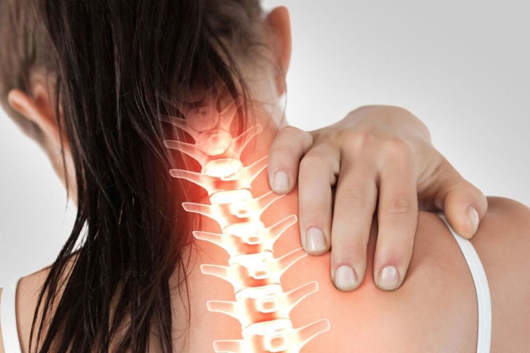 zervikale Osteochondrose bei einer Frau