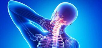 Ursachen für zervikale Osteochondrose