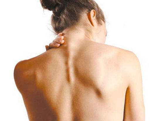Das Mädchen leidet an zervikaler Osteochondrose