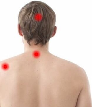 Schmerzort bei zervikaler Osteochondrose