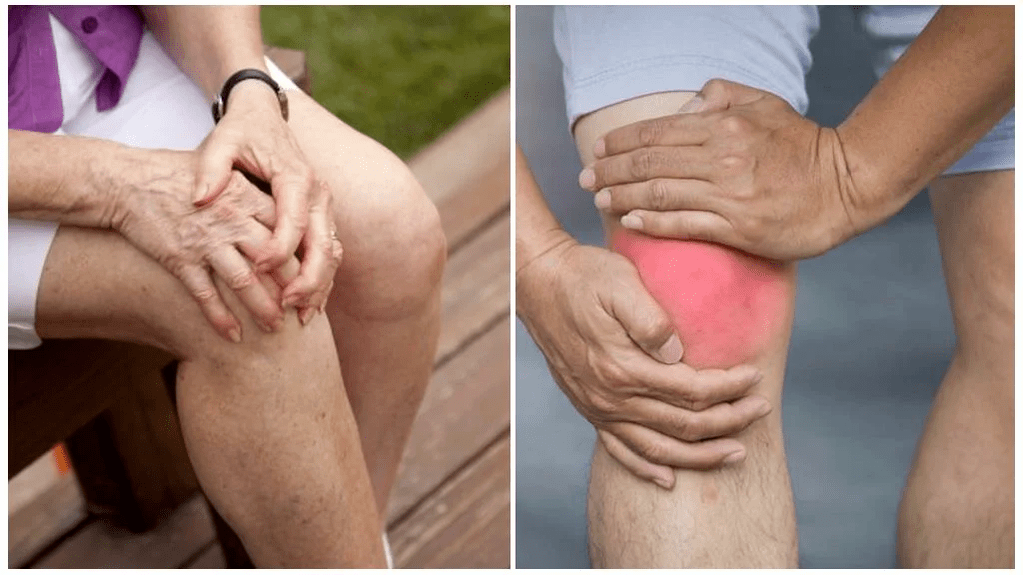 Arthrosebehandlung